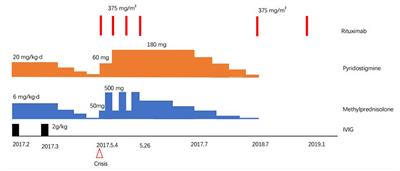 Juvenile Generalized Myasthenia Gravis With AChR and MuSK Antibody Double Positivity: A Case Report With a Review of the Literature